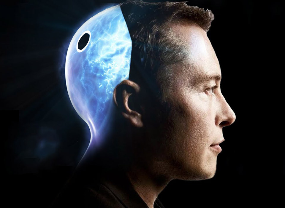 Elon Musk's brain-implant company Neuralink has gotten approval from the FDA