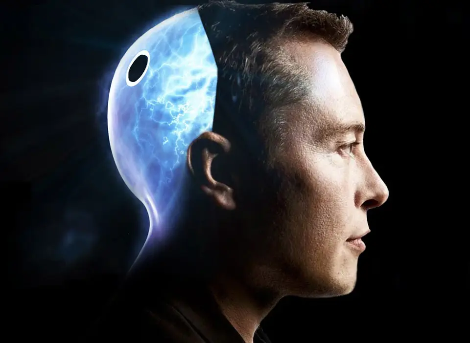 Elon Musk's brain-implant company Neuralink has gotten approval from the FDA