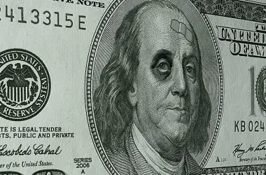 us dollar hurt